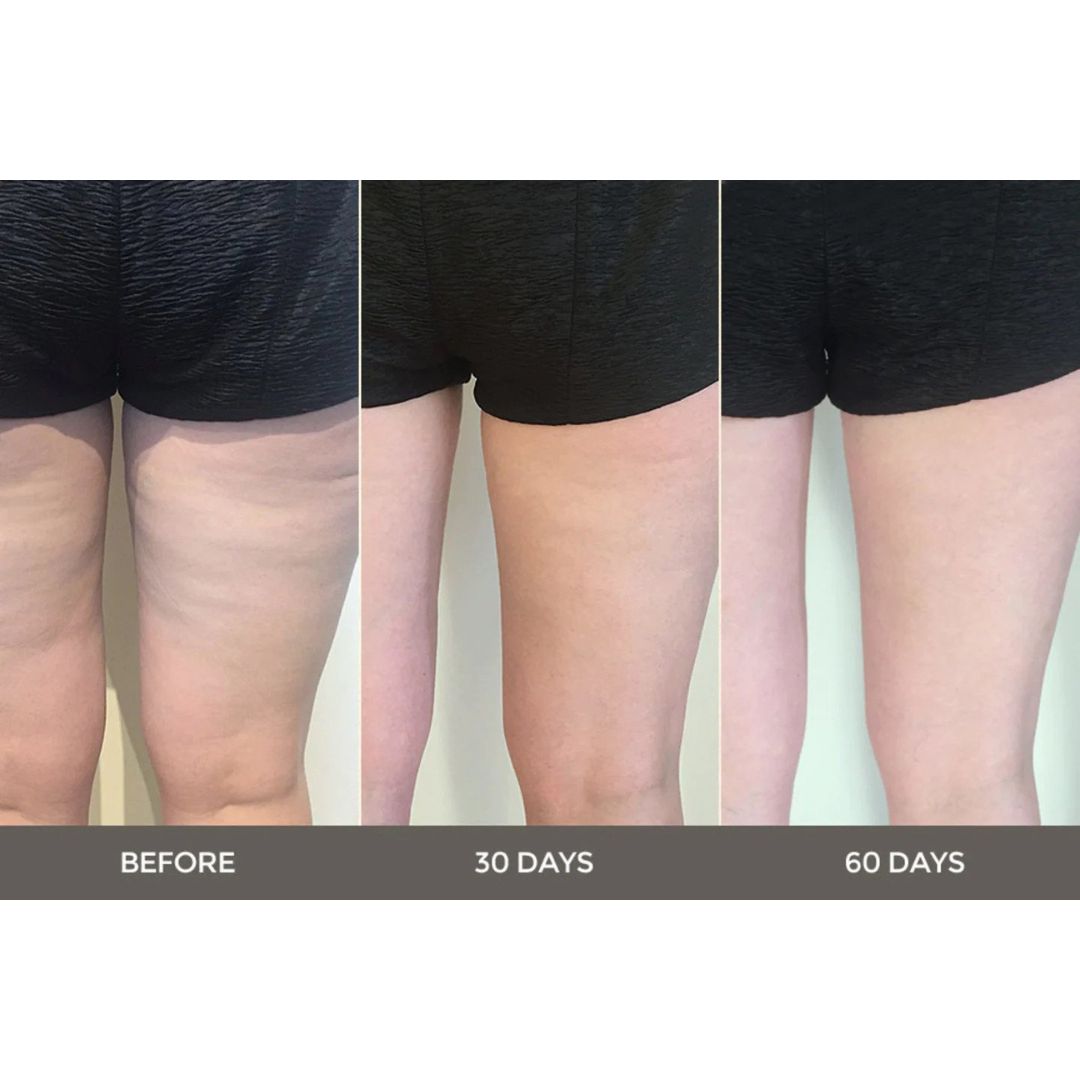 ageLOC Dermatic Effects Body Trio