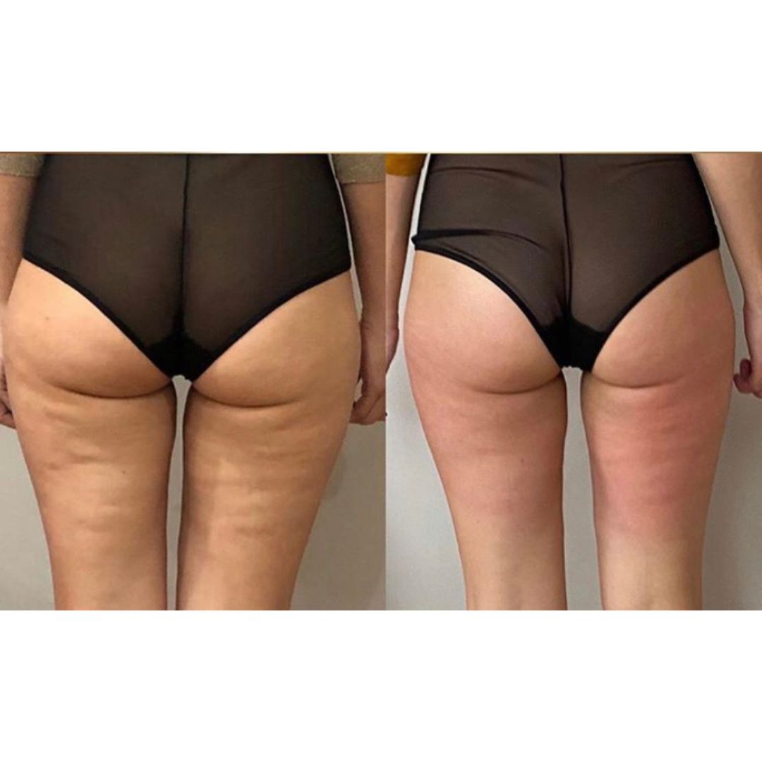 ageLOC Dermatic Effects Body Trio