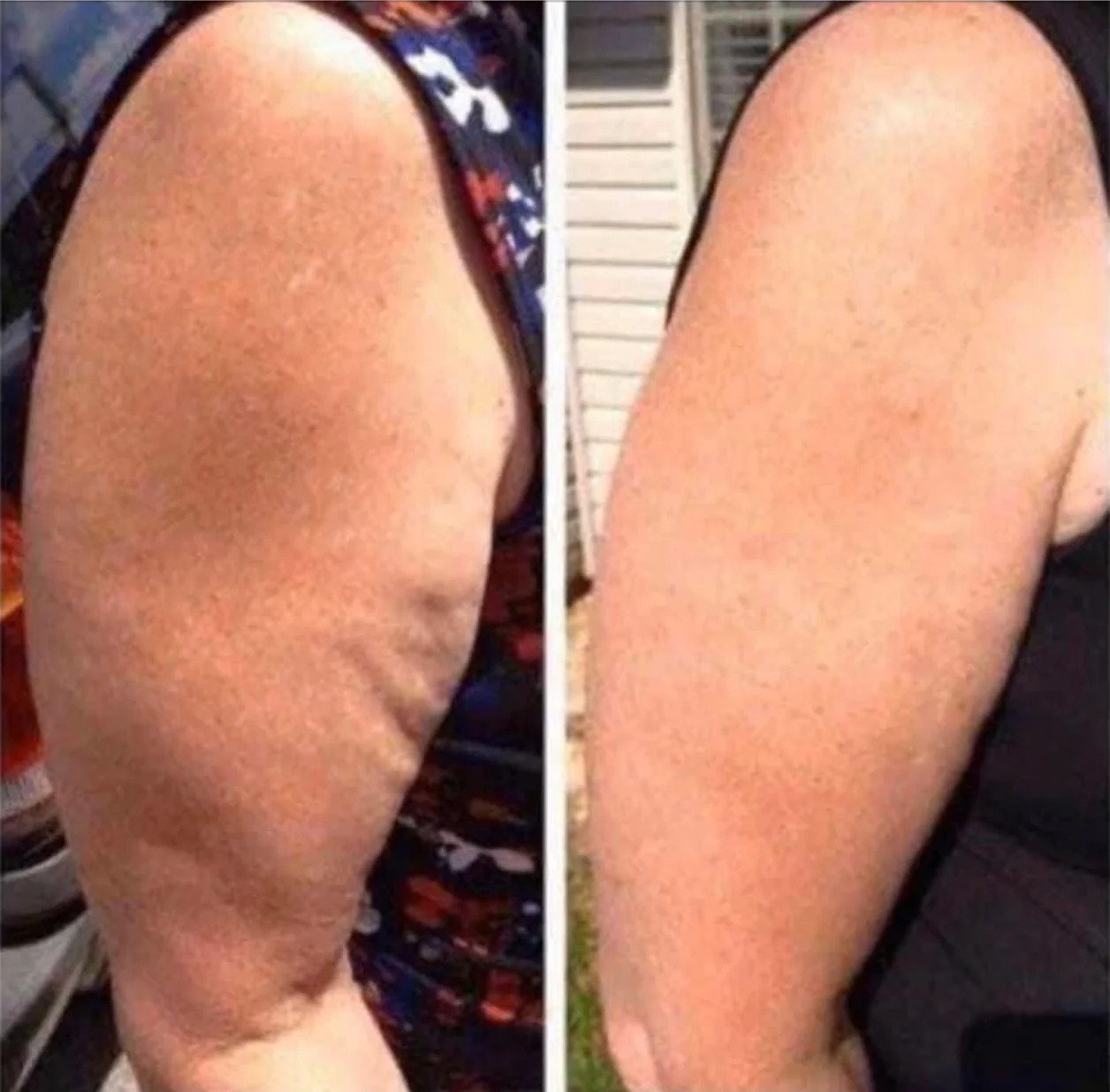 ageLOC Dermatic Effects Body Trio